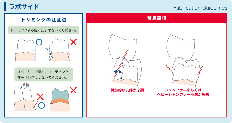 保険CAD/CAM冠のプレパレーションガイド（ラボサイド）