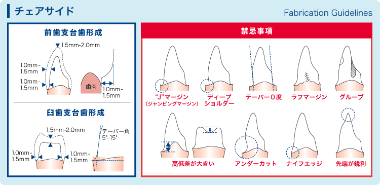 ジルコニア製品のプレパレーションガイド（チェアサイド）