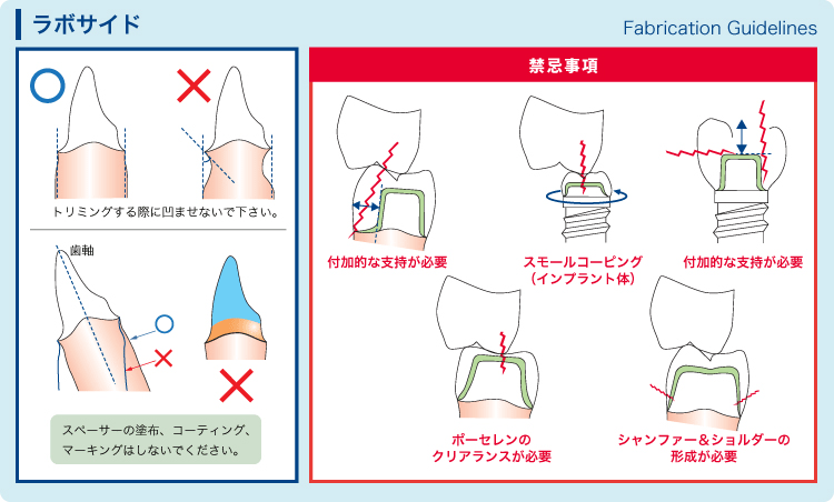 ジルコニア製品のプレパレーションガイド（ラボサイド）