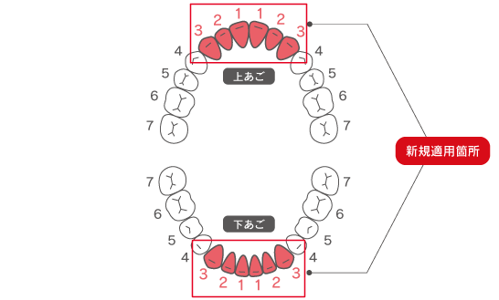 前歯保険CAD/CAM冠の保険適用範囲