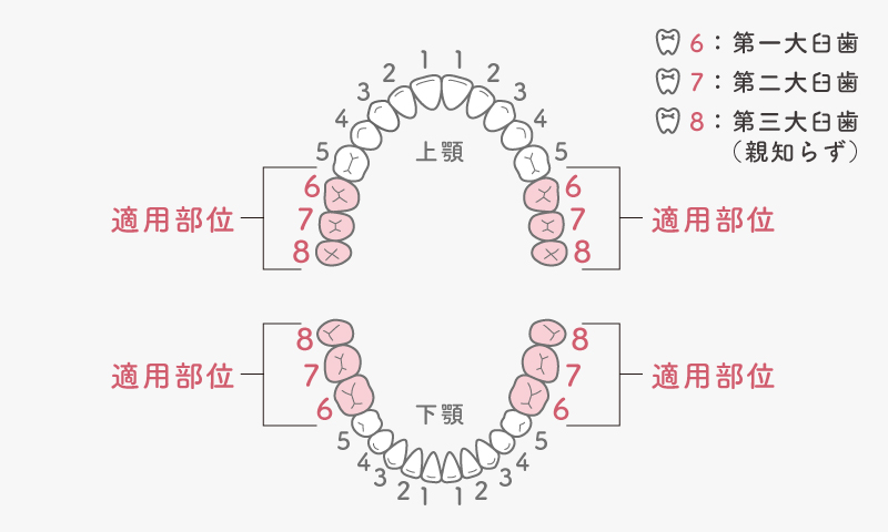 前歯保険CAD/CAM冠の保険適用範囲