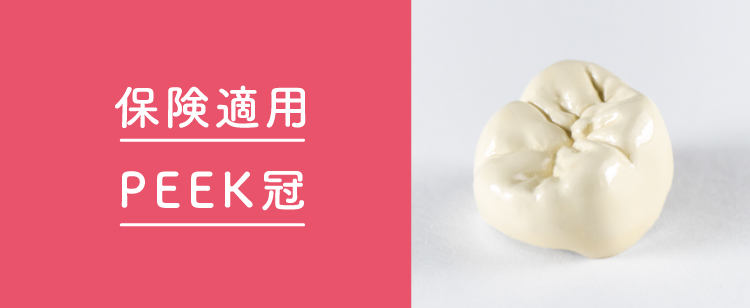 保険適用PEEK冠